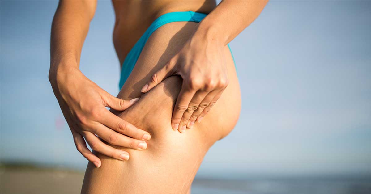 Come combattere la cellulite